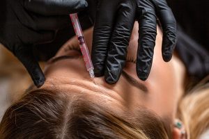 بوتاکس؛ فراتر از رفع چروک (از درمان میگرن تا پیشگیری در جوانی)